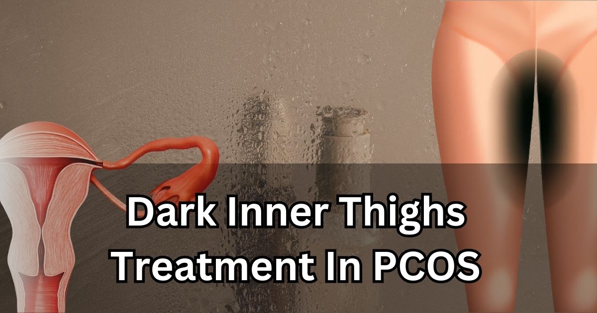 PCOS-Dark-Inner-Thighs-Treatment