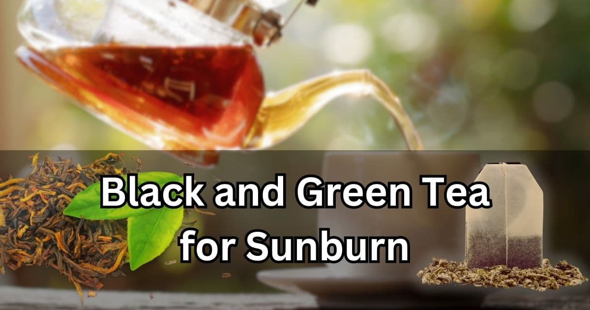 black tea for sunburn
